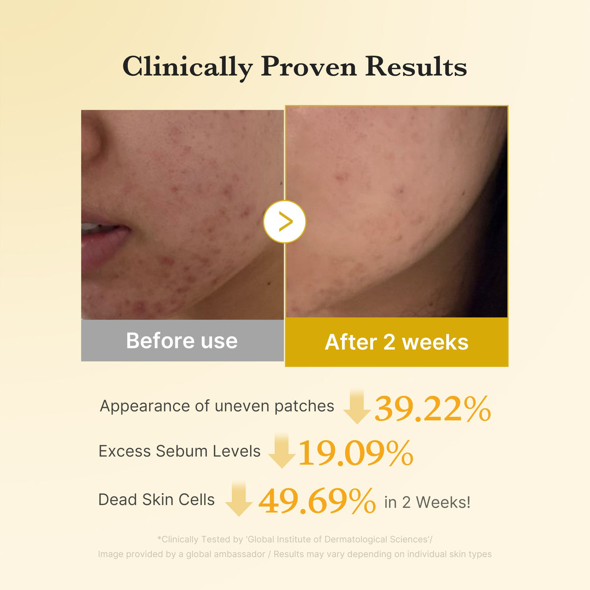[Subscr.] Kojic Acid Tumeric Toner Pad