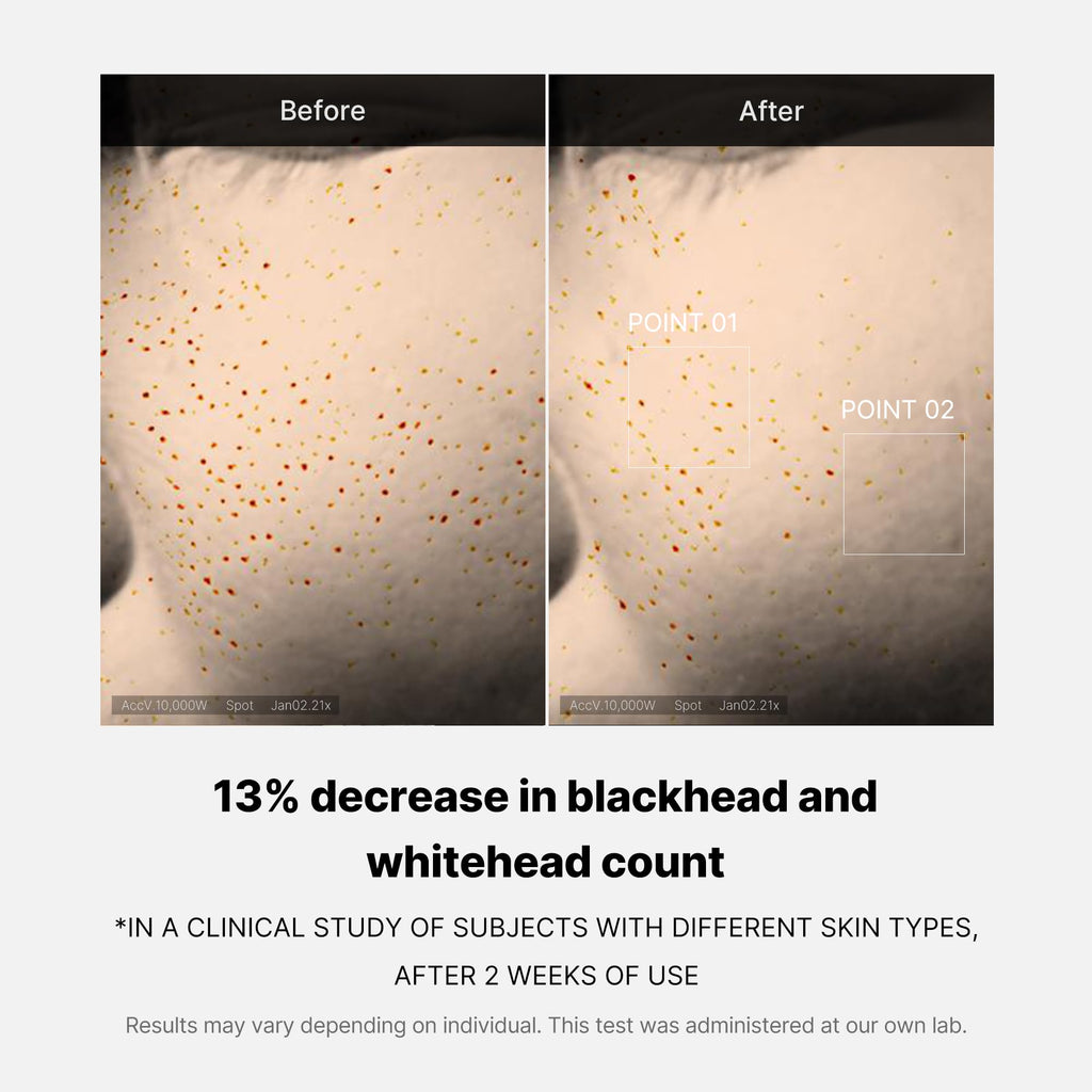 [Subscr.] Zero Pore One-day Peptide Serum