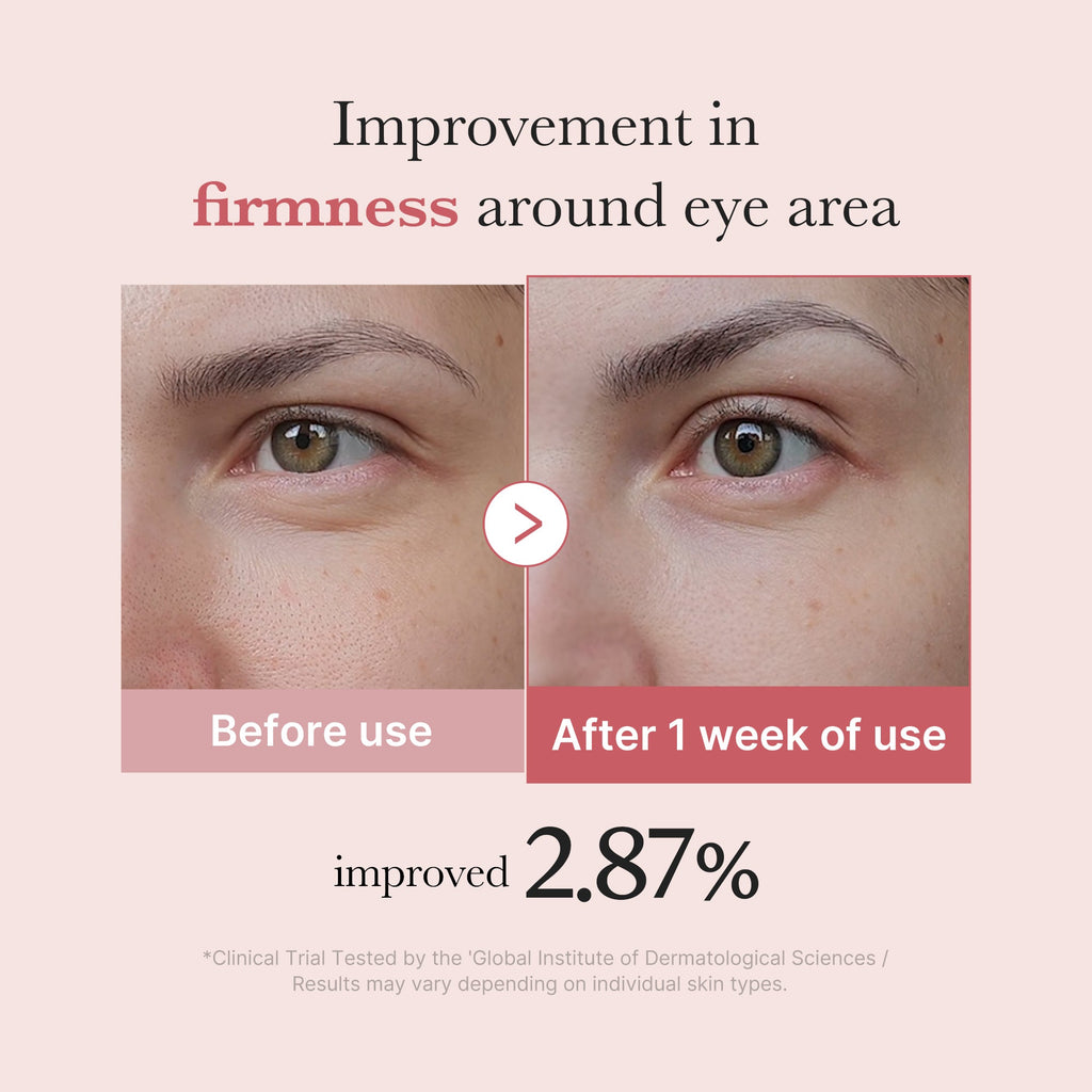 [Subscr.] PDRN Pink Peptide Eye Cream